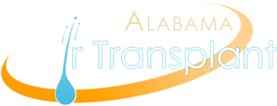 Alabama Hair Transplant